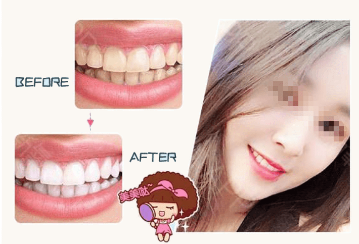 梦境解析，门牙未落，修复之梦的深层含义