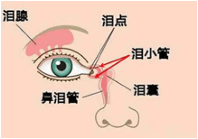 泪囊炎治疗,应把握最佳时机