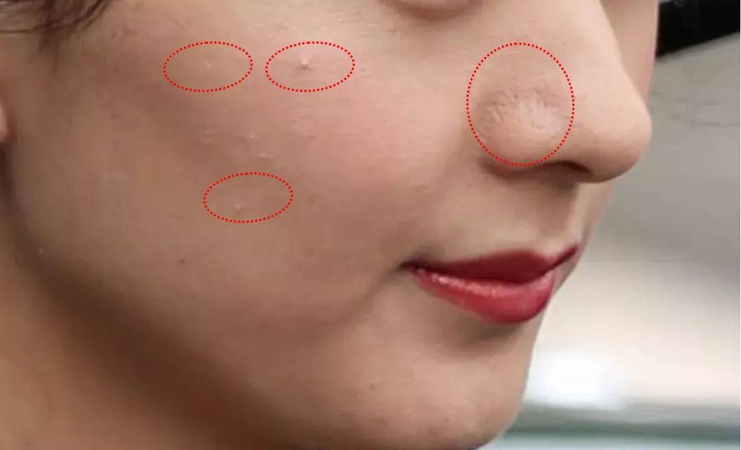 毛孔|权志龙，你真的不能再整了啊...