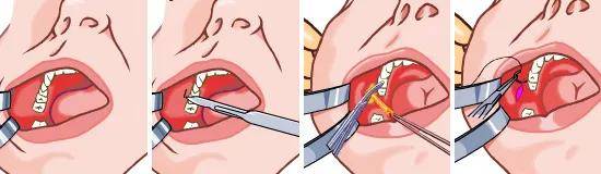 半藏|撞脸半藏森林美上天，却非要整成阿凡达，这位女明星何必呢？