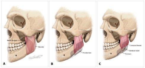 半藏|撞脸半藏森林美上天，却非要整成阿凡达，这位女明星何必呢？