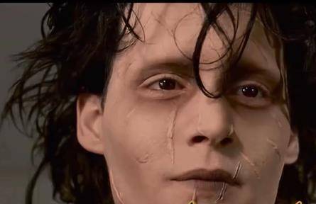 伤疤|收起你的廉价同情心，以疤痕为丑的时代即将结束，伤痕美学兴起！