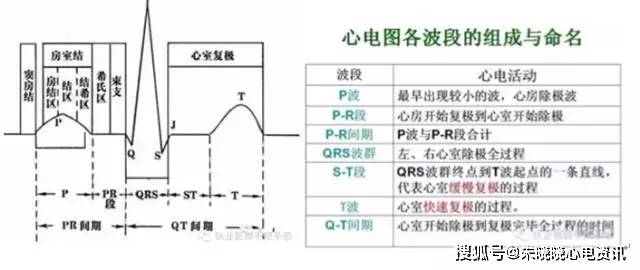 心电图记录的是心肌细胞除极和复极过程中电位变化.一,各波形的意义