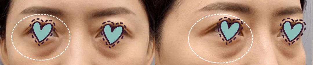 眼睛|300亿纯天然公主“下嫁”3年,40岁生两女还艳压无数小花