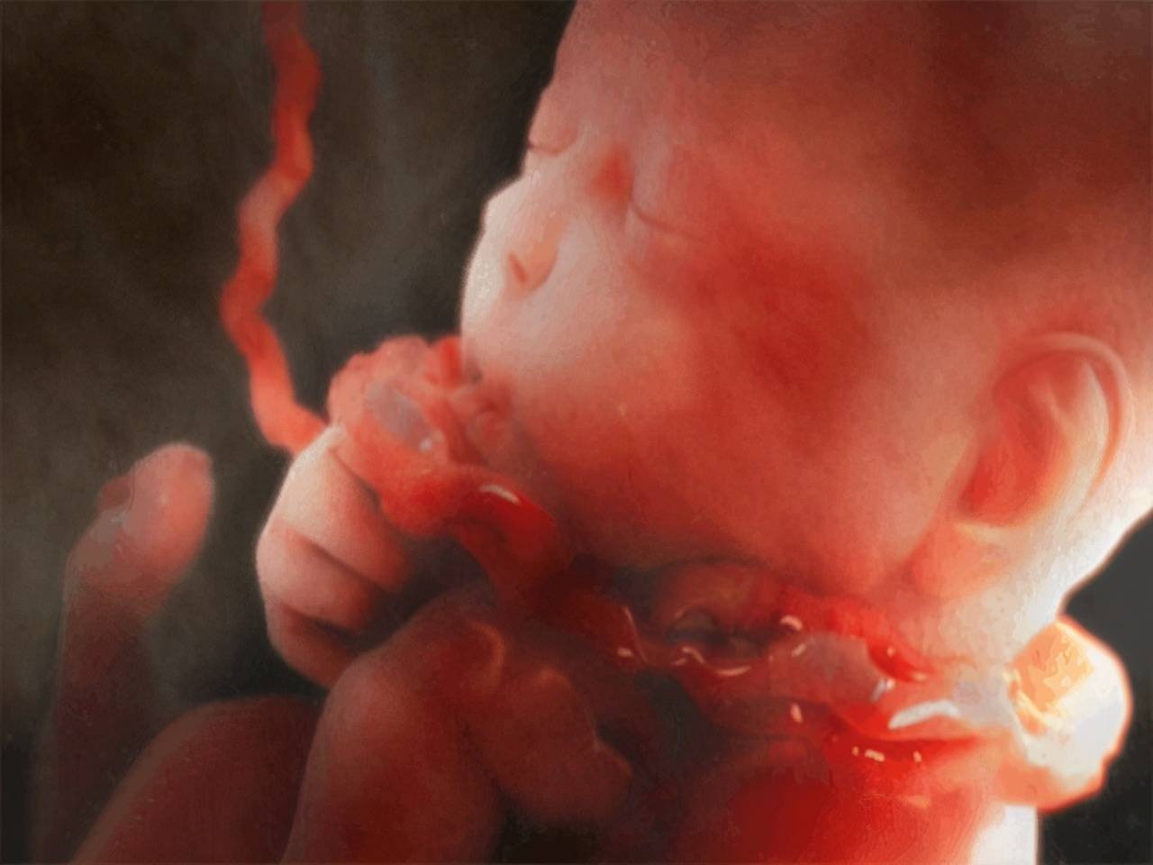 与胎儿睡觉的姿势有关 孕妇肚子的形状与胎儿在肚子里的姿势有关,胎儿