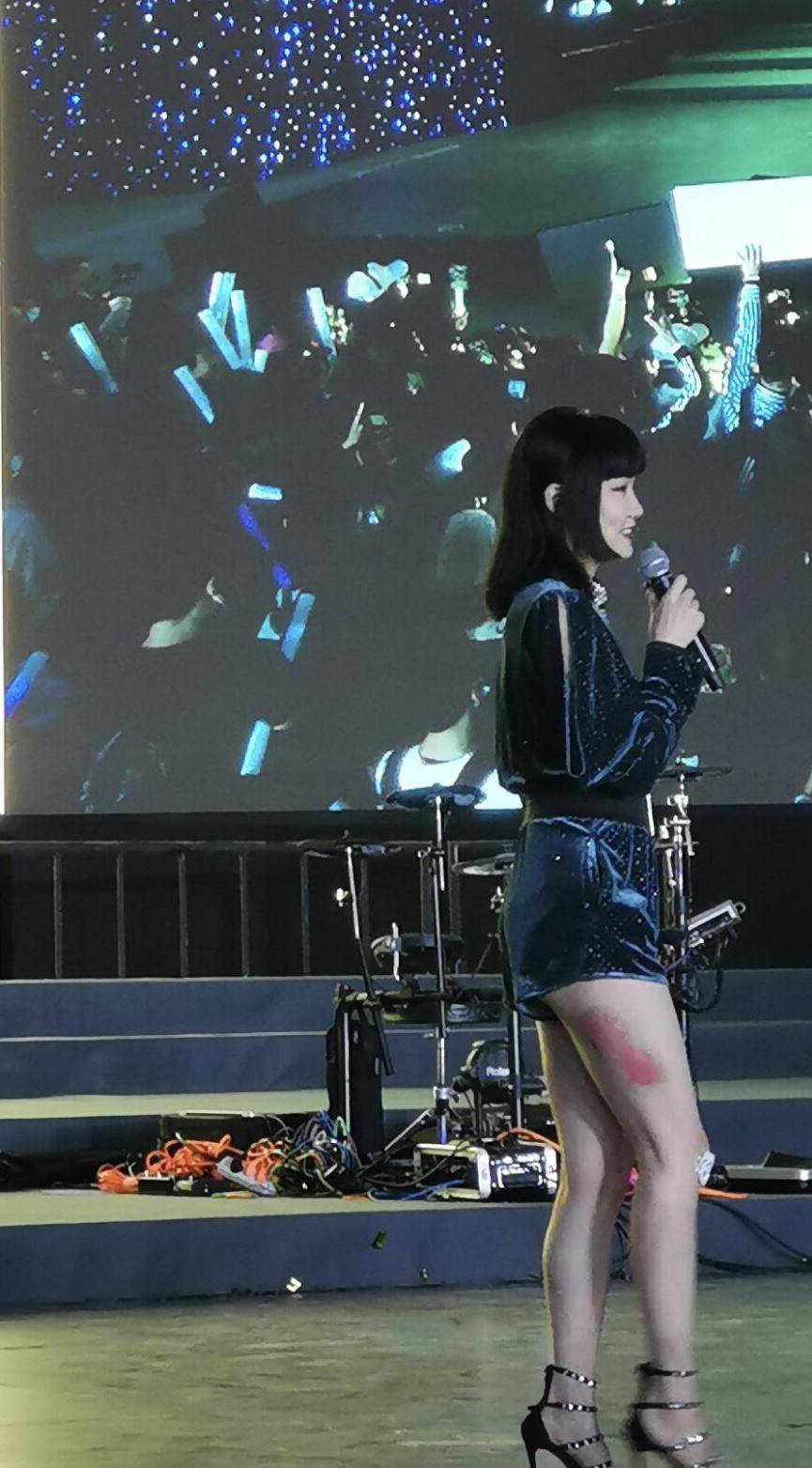 黄龄摔下舞台后首次亮相创可贴格外惹眼不愧是乘风破浪的姐姐