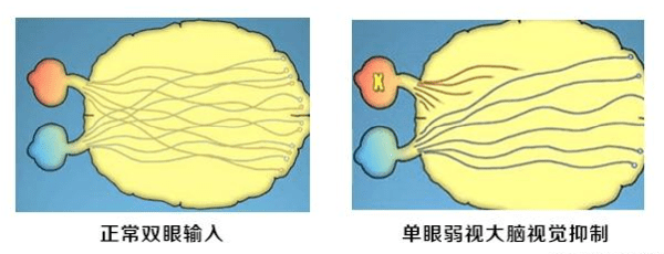 视力|“配镜后，孩子说还是看不清”一位母亲倒出缘由