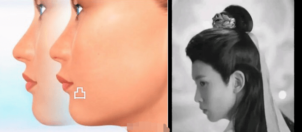 宋茜|苦练十年都翻不了身，什么样的表情管理方法才能拯救宋茜？