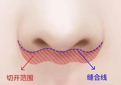 蔡明|28岁就蔡明化，热巴的脸这个月又陷颜值低谷...