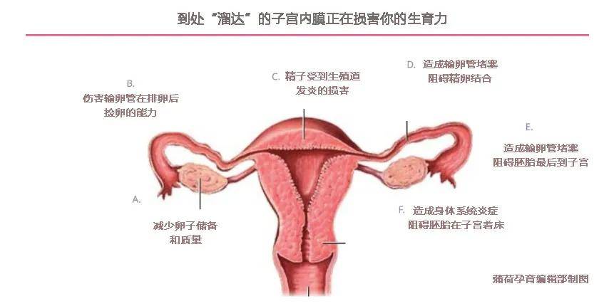 吃什么能快速增加子宫内膜 b38843ade04545808060cdc5e31b6fdc.jpeg