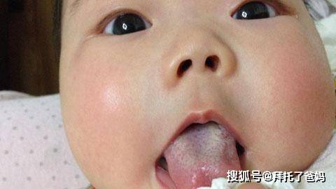 孩子|脸上发现3种迹象，脾胃已经不堪负重了孩子积食是拖出来的