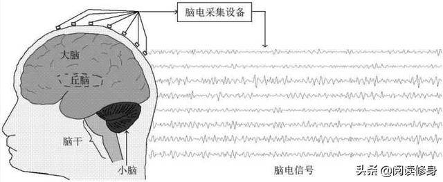 脑电采集设备示例以前采集的时候头部布满电极.