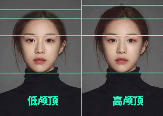 头发|高颅顶对颜值有多重要？Jennie秀妍都有话要说