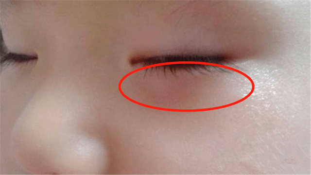 孩子|还是尽早拉黑,宝宝常吃,毛病多得不偿失伤脾胃的凶手抓到了