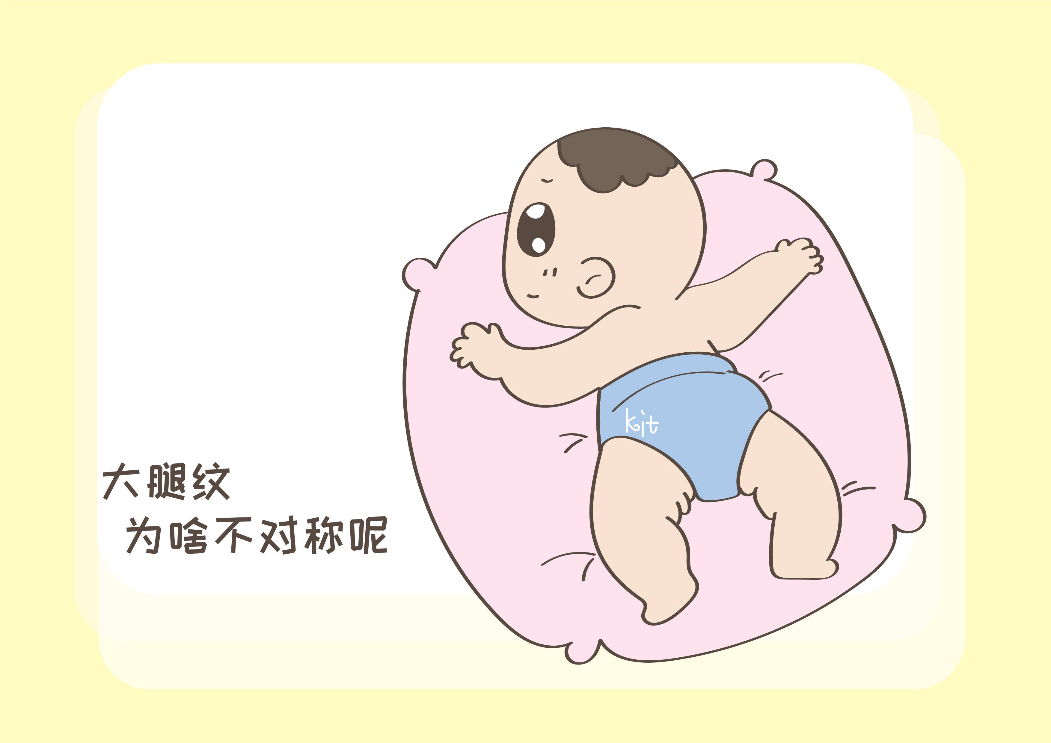 孩子|宝宝的大腿纹为啥不对称？这是什么情况？带你一起了解下