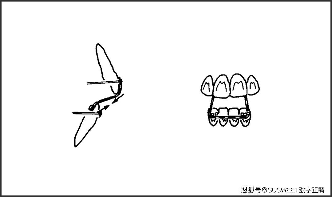 什么牙切齿成语_成语故事图片(2)
