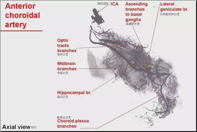 认识脉络膜前动脉:从解剖到临床
