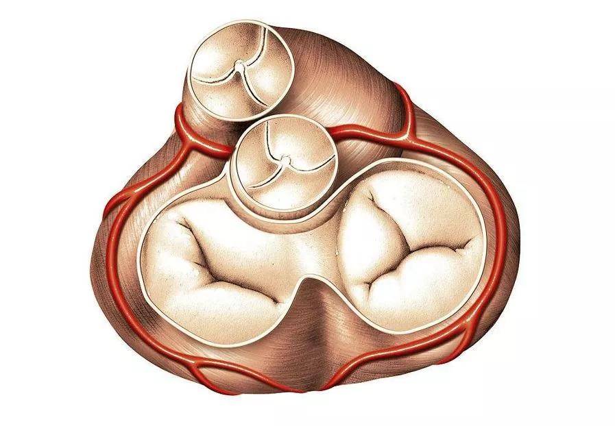 发现了二尖瓣三尖瓣少量反流是什么原因要怎么办