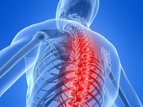 胸椎,腰椎和尾椎,从颈椎到尾椎整个范围都可出现疼痛症状