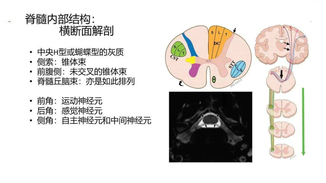 实用脊髓的解剖和定位诊断