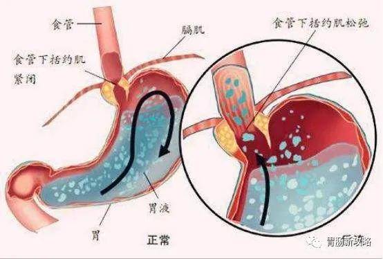 人口静流入_纵观深圳,人口流向决定经济,回迁房再添新高度(2)