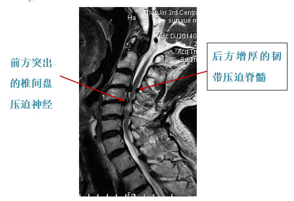 一半脑袋麻木怎么办