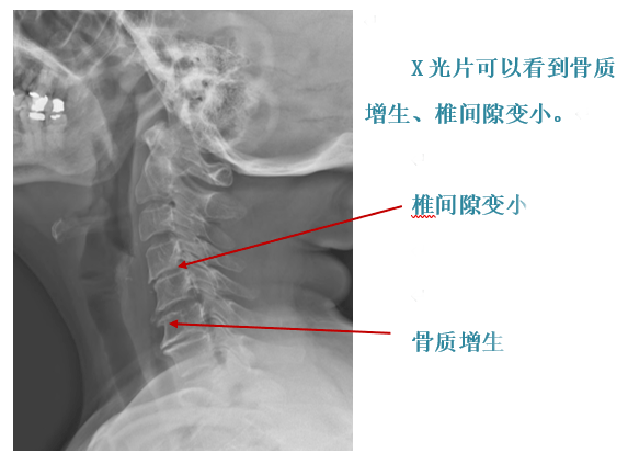 一半脑袋麻木怎么办