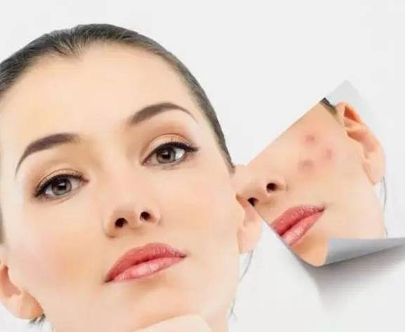 怎么才能不长黑色素 3d01dada7c1b490391f567c2f5cf473c.jpeg