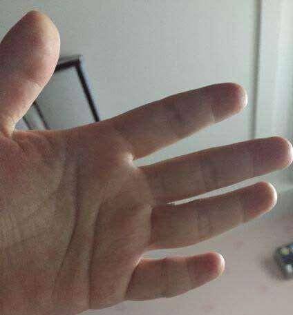 小指什么成语_成语故事图片(2)