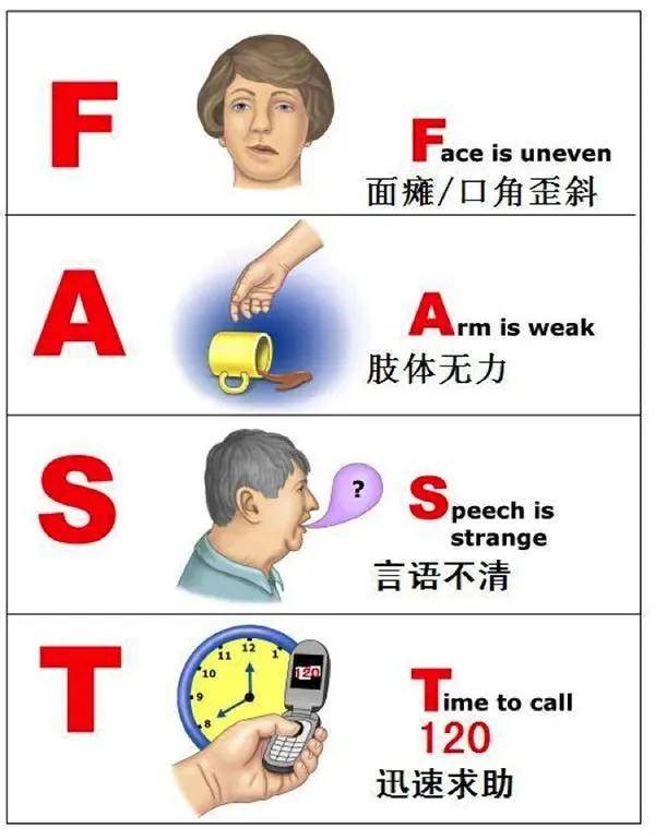 【科普知识】时间就是大脑—正视卒中,可防可治
