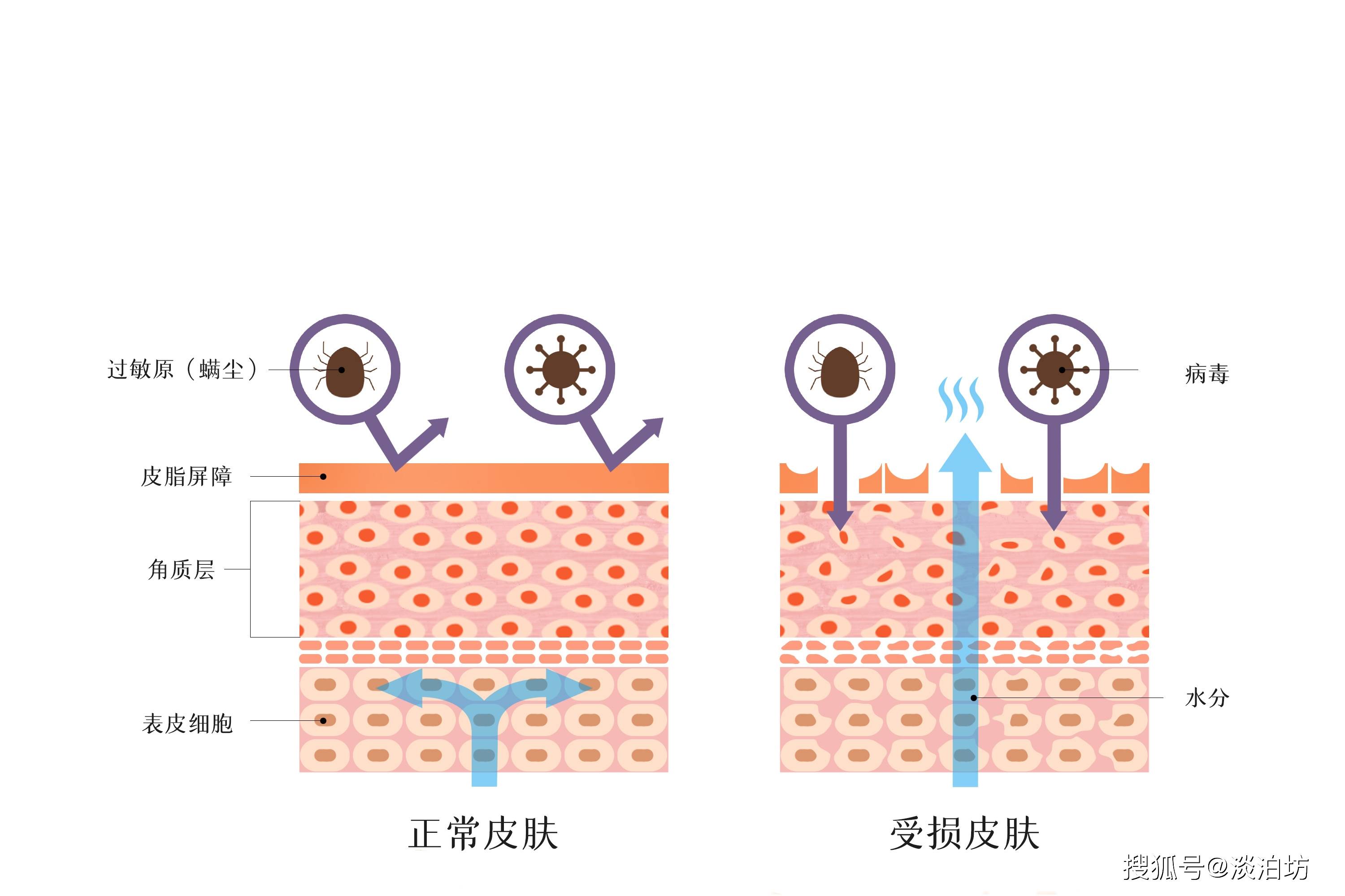 (皮肤屏障)