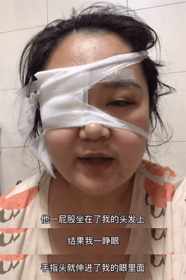 原创照顾宝宝时被戳眼,导致眼球,角膜划伤,宝妈们真的要注意
