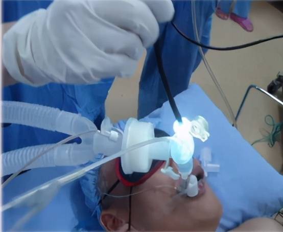以2011年为界限,2011年前以各种可视喉镜,纤维支气管镜等辅助视频