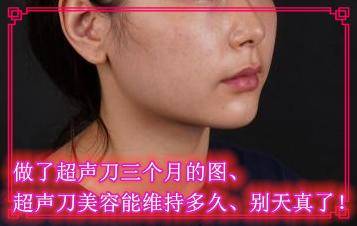 e016da1ff8d441849ada9bf8405cce8c.jpeg
