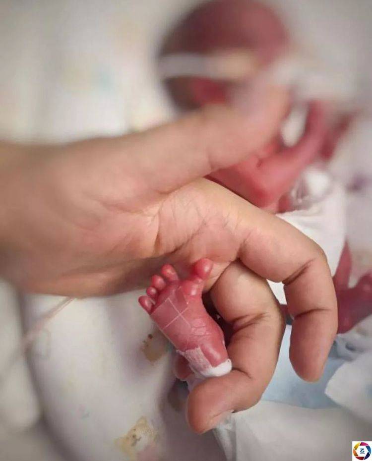 孩子只在妈妈肚子里待了26周,出生时的没有呼吸,没有心跳,体重只有580