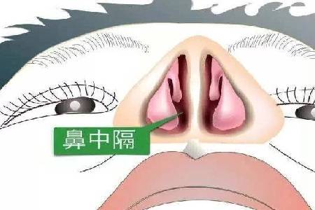 贵阳铭仁耳鼻喉医院鼻中隔偏曲危害大预防是关键技巧在这里