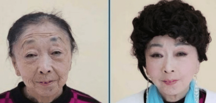 原创还记得为真爱整容成少女,嫁给25岁小伙的60岁老太吗?现状如何