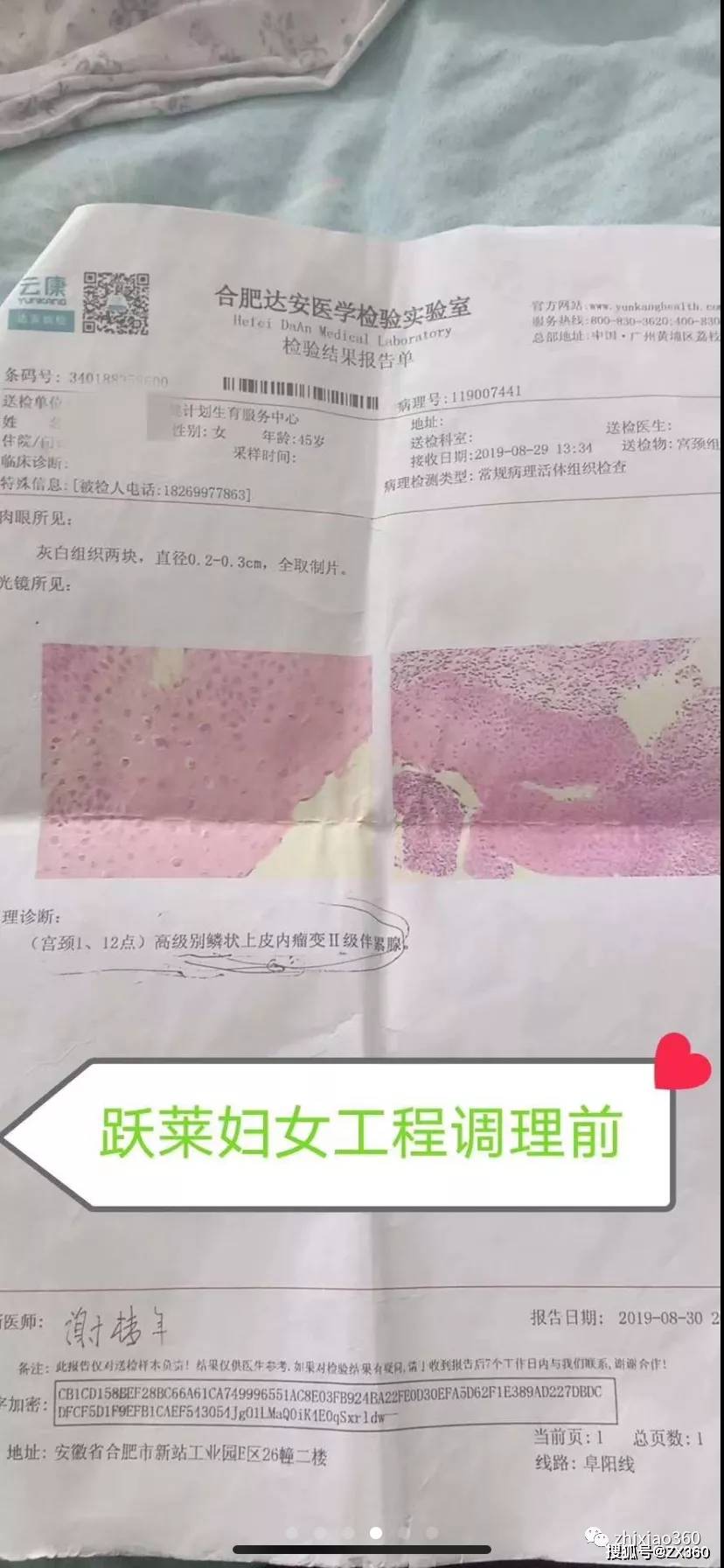 武汉跃莱无牌照一个盘两种制度其下妇洁宝宣称能治疗各种妇科疾病