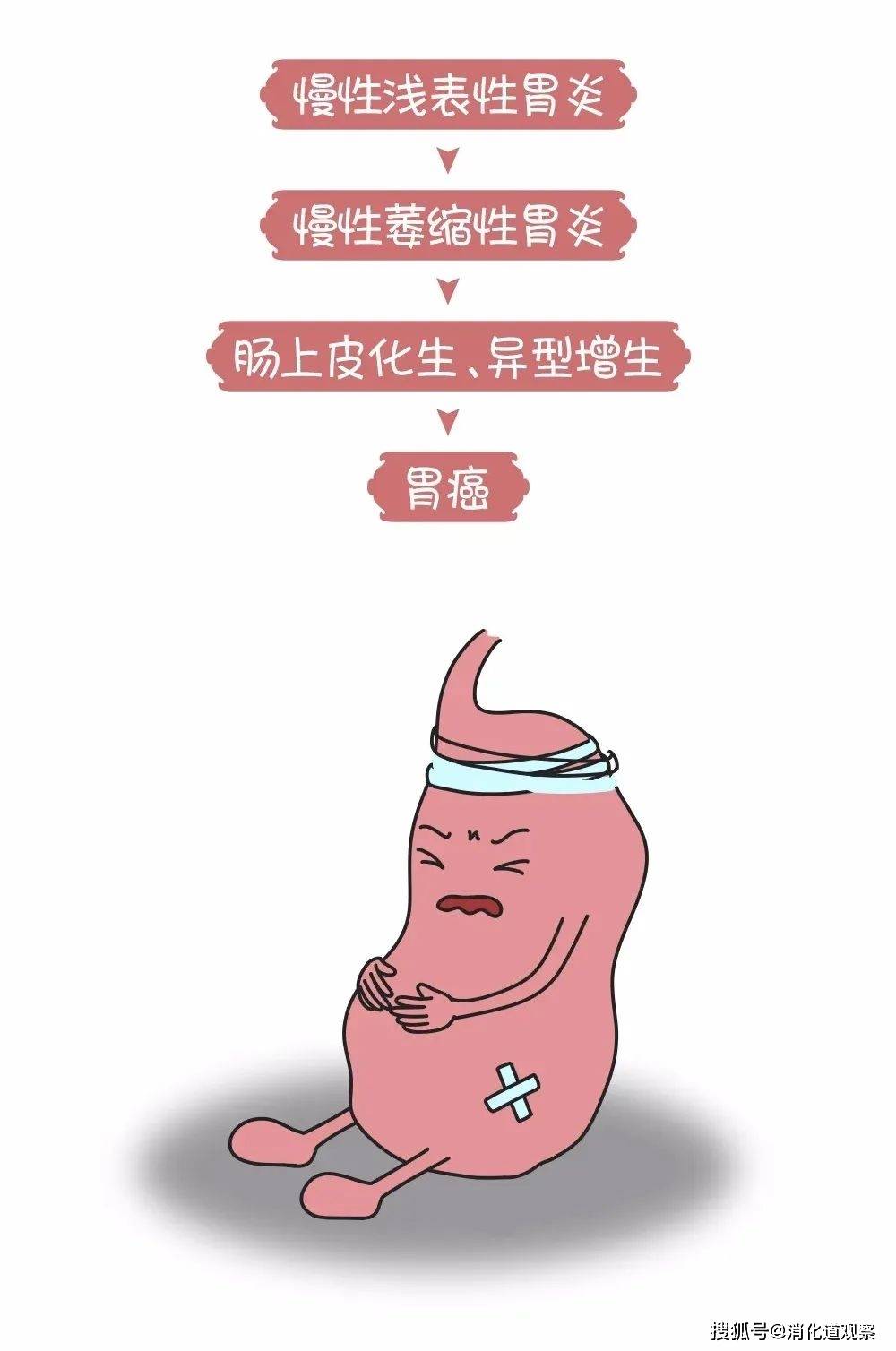 从胃炎到胃癌,只需要4步 大概需要5-10年,甚至更短.