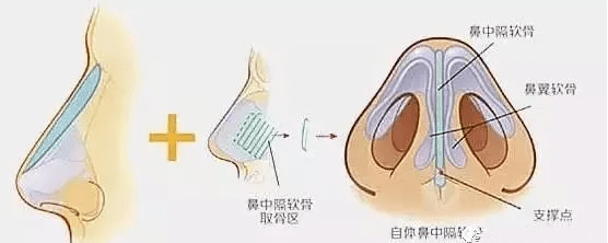 鼻渊和鼻鼽区别 来自搜狐网