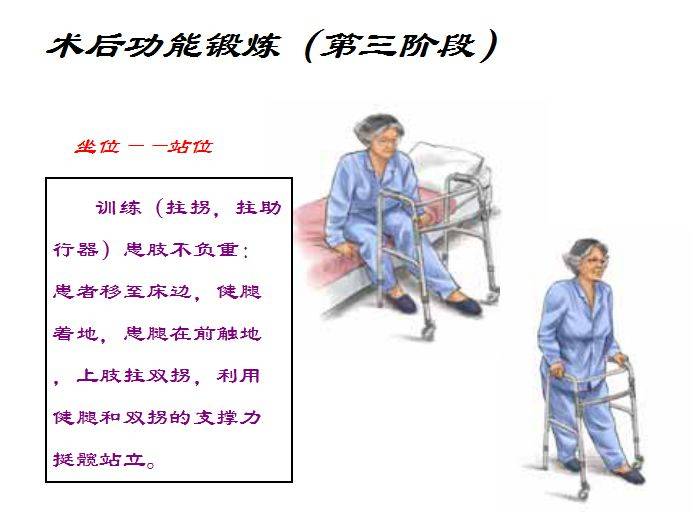 骨折术后的康复功能锻炼含上肢下肢图文演示