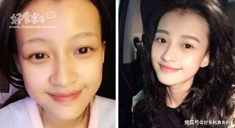 原创孙怡承认割双眼皮了吗 闭眼之后的痕迹仍然很明显