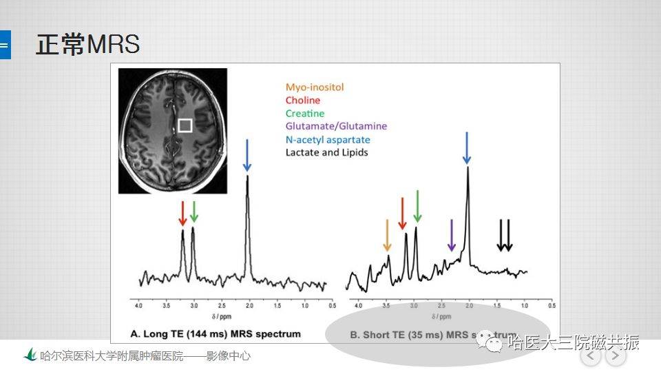 磁共振波谱成像mrs的原理及临床应用