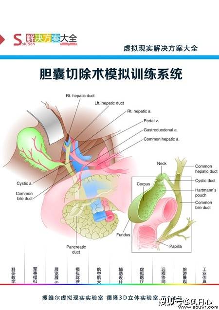 sep胆囊切除术学习模块侧重于训练切除胆囊,同时将胆管及周围结构的