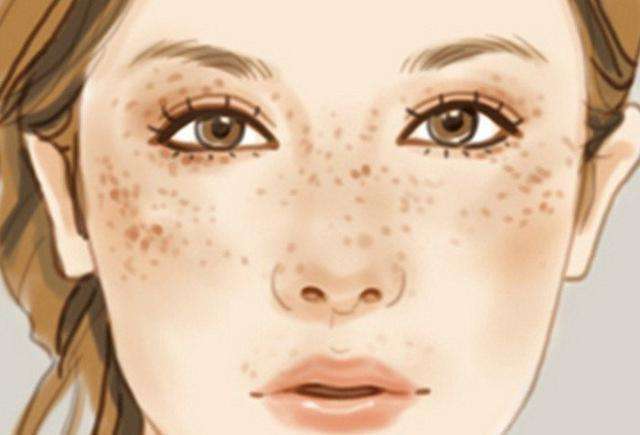 女人脸上这些部位长斑千万要注意了别以为只是皮肤问题