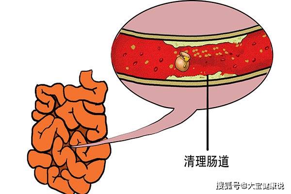 常吃对改善肠道环境是很有效果的,可以帮助清理肠道更干净,肠道健康