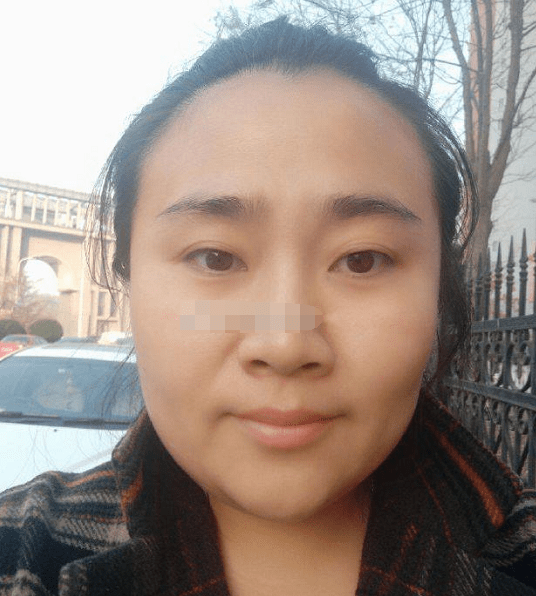 原创颧骨微凸,情感中有控制欲,驿马宫毛发侵袭,不适合远嫁