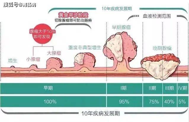 绿豆大的肠息肉,短短2年变早期肠癌——哪些肠息肉需要切除?