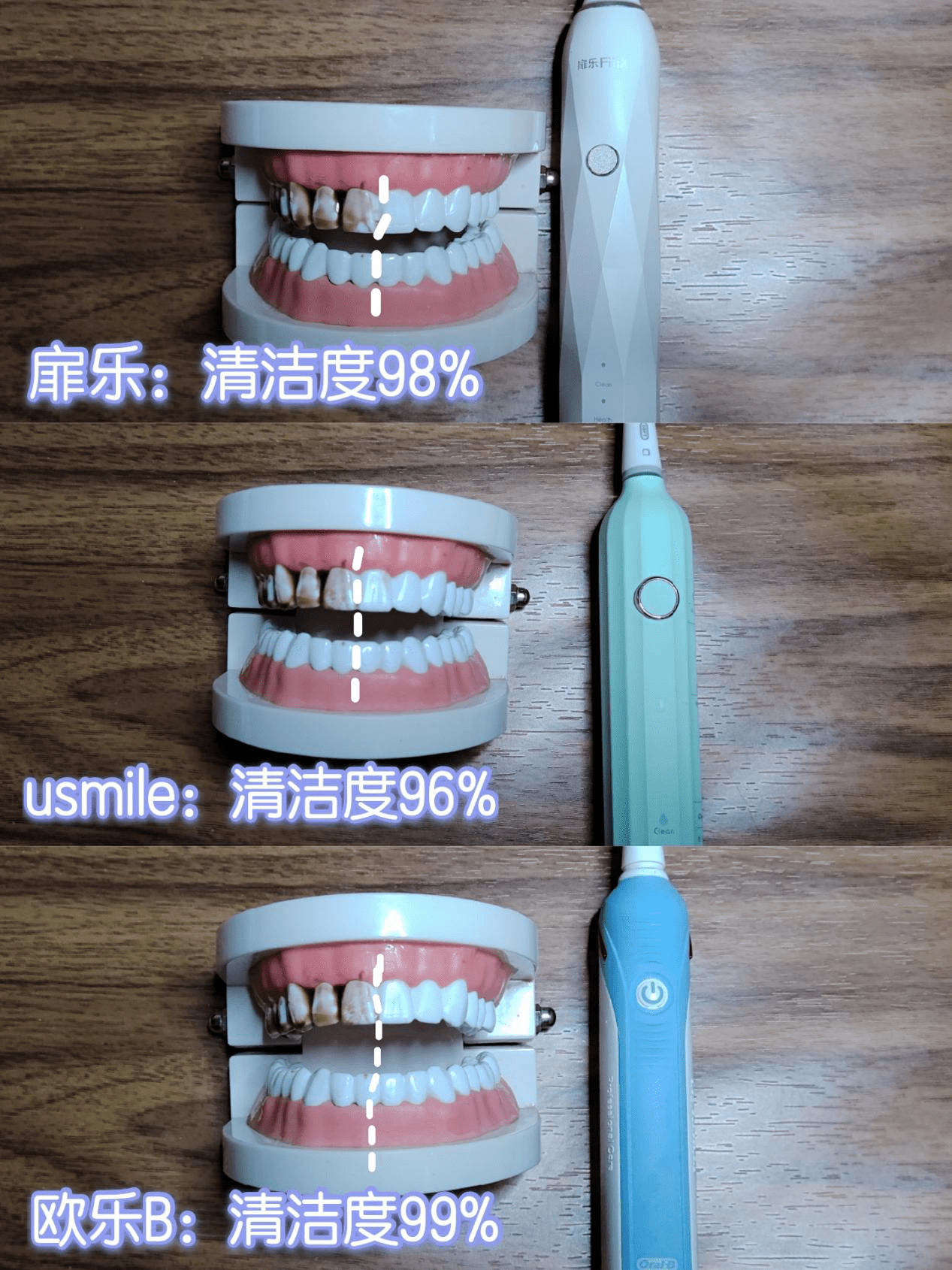 电动牙刷哪个牌子好,超全对比不伤牙扉乐/欧乐b/usmile_牙齿