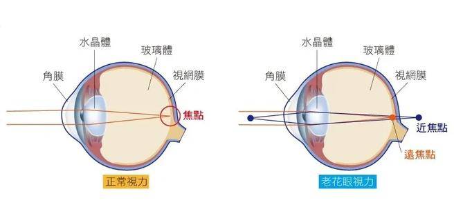 主要体现在眼球的调节能力变差,在看近处时,不能使物体成像在视网膜上
